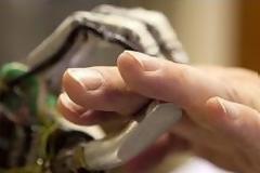 Ρομποτικός βραχίονας - βελόνα φέρνει επανάσταση στη χειρουργική