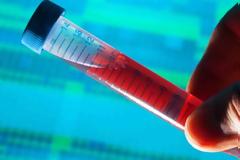 Διαγνωστικές εξετάσεις: Έρχεται άγριο κούρεμα από Σεπτέμβριο για
ασθενείς-διαγνωστικά κέντρα