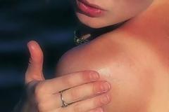 Έγκαυμα από τον ήλιο: Γιατί προκαλεί φαγούρα και πώς να την σταματήσετε