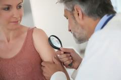 Πότε μια ελιά εξελίσσεται σε επικίνδυνο μελάνωμα;