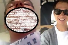 Απίστευτο: Ήθελε κάτασπρα δόντια - H κατάληξη είναι τρομακτική... [photo]