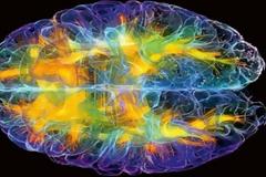 Η περιοχή του εγκεφάλου που κάνει τον άνθρωπο μοναδικό...