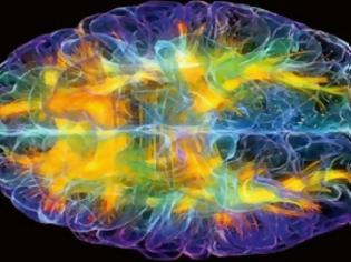 Φωτογραφία για Η περιοχή του εγκεφάλου που κάνει τον άνθρωπο μοναδικό...