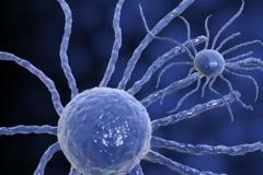 Όλη η αλήθεια για το κείμενο της Νατάσας Καραμανλή για τον καρκίνο