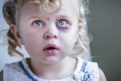 ΣΟΚΑΡΙΣΤΙΚΟ: Όταν αυτή η 6χρονη κάλεσε την αστυνομία για τον πατριό της, δεν περίμενε εκείνος να… [video]