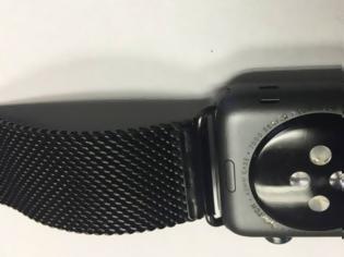 Φωτογραφία για Η Apple αντικαθιστά τα Apple Watch που ξεθωριάζουν τα γράμματα τους στην πίσω πλευρά