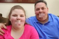 Εικόνες που προκαλούν ανατριχίλα! Δεν μπορείς να φανταστείς τι κρύβουν στο στόμα τους μπαμπάς και κόρη! [photos+video]