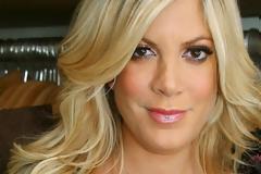 Σοκαριστικές εικόνες: Η παραμόρφωση της Tori Spelling μετά από χημικό πήλινγκ