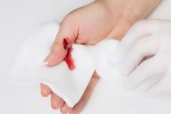 Οξυζενέ στην πληγή: Επιτρέπεται ή όχι;