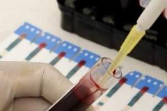 Πρωτοποριακό τεστ αίματος προβλέπει την επανεμφάνιση του καρκίνου του μαστού