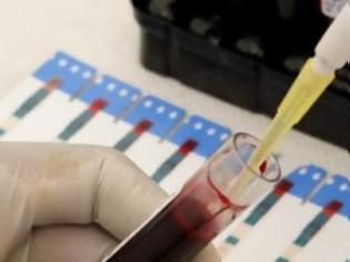 Φωτογραφία για Πρωτοποριακό τεστ αίματος προβλέπει την επανεμφάνιση του καρκίνου του μαστού