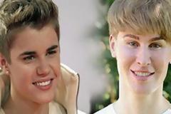 Νεκρός ο σωσίας του Τζάστιν Μπίμπερ - Είχε ξοδέψει 100.000 δολάρια στις πλαστικές