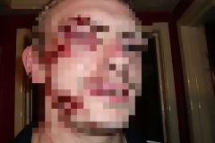 ΣΑΛΟΣ στην showbiz: Έφαγε ξύλο γνωστός Έλληνας τραγουδιστής - Τον πλάκωσε ο άντρας της 