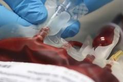 Πάτρα: Έκκληση για αίμα από τους συγγενείς του Λύσανδρου Καραθανάση