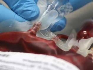 Φωτογραφία για Πάτρα: Έκκληση για αίμα από τους συγγενείς του Λύσανδρου Καραθανάση