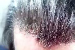 ΑΗΔΙΑ: Μετά από αυτό θα λούζεις τα μαλλιά σου 5 φορές την ημέρα [video]