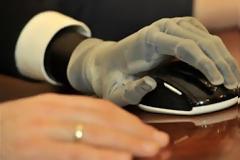 Προσθετικό «χέρι» επιτρέπει σε παράλυτο να νιώθει ξανά την αίσθηση της αφής