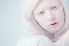 Καθηγητής σκόπευε να πουλήσει μαθήτρια του που ήταν αλμπίνο