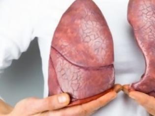 Φωτογραφία για Καρκίνος του πνεύμονα: Αυτές είναι οι πρώτες ενδείξεις