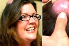 Αποφάσισε να «σπάσει» την τεράστια κύστη που είχε για 20 χρόνια - Δείτε  το βίντεο με δική σας ευθύνη!