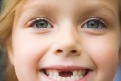 Το χρόνιο στρες της μητέρας αυξάνει τα χαλασμένα δόντια στα παιδιά