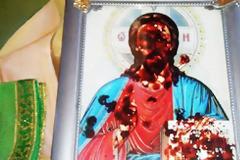 Συγκλονιστικό: Εικόνες αιμορραγούν στην Κριμαία