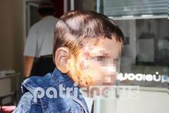 Πύργος: Παρενέβη η εισαγγελέας για την υπόθεση του 2χρονου και της 60χρονης