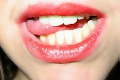 Τι πρέπει να κάνετε αν κατά λάθος δαγκώσετε τη γλώσσα σας