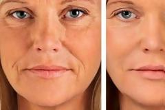 Αυτό είναι το θαυματουργό φρούτο που σβήνει τις ρυτίδες και κόβει την όρεξη!  Εσύ το ήξερες;