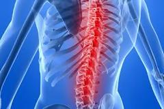 3 συνήθειες που επιβαρύνουν την σπονδυλική στήλη