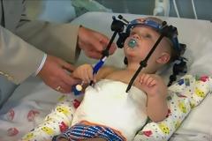 Ιατρικό θαύμα: Ξανά-συνέδεσαν με την σπονδυλική στήλη το κεφάλι μωρού