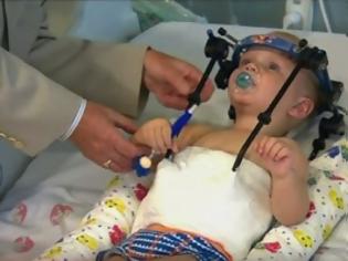 Φωτογραφία για Ιατρικό θαύμα: Ξανά-συνέδεσαν με την σπονδυλική στήλη το κεφάλι μωρού