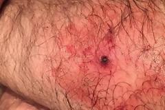 Ο γιατρός του δεν είχε ιδέα τι ήταν αυτό που είχε στο πόδι του [photos]