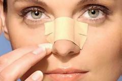 Μαύρα στίγματα στη μύτη; Πώς θα τα εξαφανίσεις