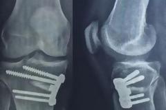 Ο ΡΙΒΑΛΝΤΟ ΚΑΙ ΟΙ... ΒΙΔΕΣ ΤΟΥ! (ΡΗΟΤΟ)