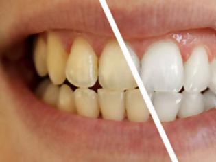 Φωτογραφία για Το μαγικό διάλυμα για πιο αστραφτερά δόντια με το βούρτσισμα