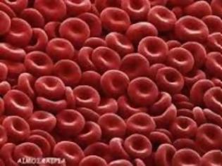 Φωτογραφία για Αληθής πολυκυτταραιμία: Οι σοβαρές επιπλοκές της σπάνιας αιματολογικής κακοήθειας