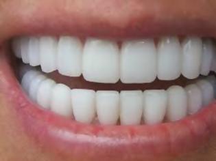 Φωτογραφία για Εσείς ξέρατε τι μπορούν να φανερώσουν τα δόντια;