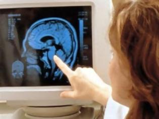 Φωτογραφία για Εξάχρονο αγοράκι το μοναδικό στον κόσμο με σπάνιο όγκο στον εγκέφαλο