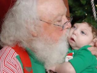 Φωτογραφία για Το μωράκι που γεννήθηκε χωρίς εγκέφαλο γιορτάζει τα Χριστούγεννα