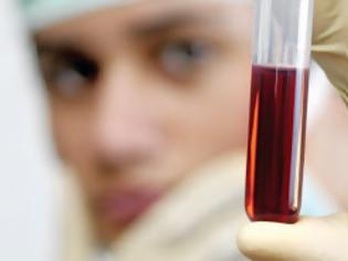 Φωτογραφία για 1 τεστ αίματος μια φορά τον χρόνο μπορεί να σας σώσει από καρκίνο των ωοθηκών