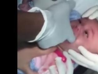 Φωτογραφία για Το μωρό της δεν μπορούσε να αναπνεύσει - Όταν πήγε στο Νοσοκομείο, δείτε τι έβγαλαν από το Λαιμό του [photo]