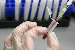 Ένα τεστ αίματος θα προειδοποιεί για τον καρκίνο του μαστού