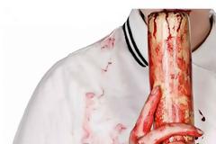 Τρόμος για ζευγάρι ηλικιωμένων...Κουκουλοφόροι μπούκαραν με ρόπαλα στο σπίτι  τους χτύπησαν και τους λήστεψαν!