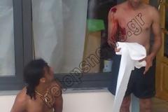 Καλαμάτα: Μαροκινός, με πριόνια στα χέρια, τραυμάτισε ομοεθνή του με σπασμένο ποτήρι…