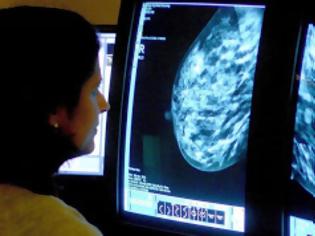 Φωτογραφία για Συνδυασμός φαρμάκων «εξαφανίζει» ακόμα και εντελώς τους όγκους του καρκίνου του στήθους