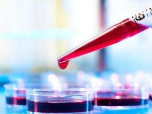 Φωτογραφία για Λήγει η προθεσμία ενστάσεων για τις «υποχρεωτικές εκπτώσεις» στις διαγνωστικές εξετάσεις!