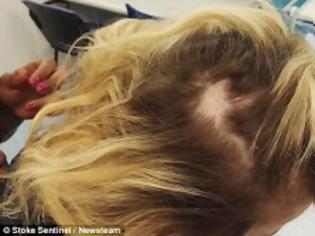 Φωτογραφία για Άγριο περιστατικό Bullying: Μια 14χρονη ξυλοκοπήθηκε άγρια από συνομήλικες της... [photo]