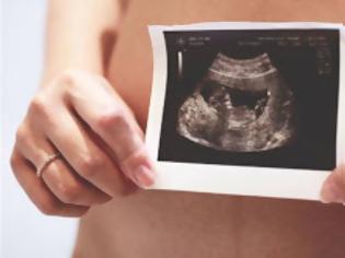 Φωτογραφία για Εκτυπωμένη ωοθήκη υπόσχεται αποκατάσταση της γονιμότητας