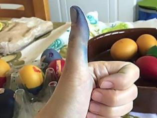 Φωτογραφία για Δοκιμασμένο κόλπο για να καθαρίσετε τα χέρια σας από τη βαφή αυγών